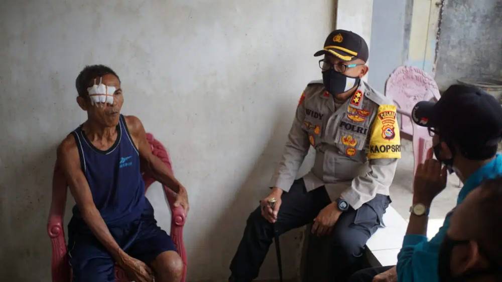 Kapolres Sumbawa AKBP Widy Saputra S.IK (TN 5) Rujuk Penderita Tumor Mata ke Mataram